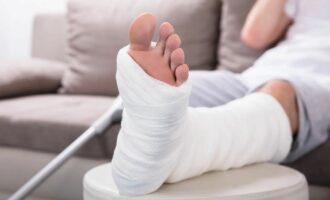 بانداژ استخوان پیزوالکتریک
