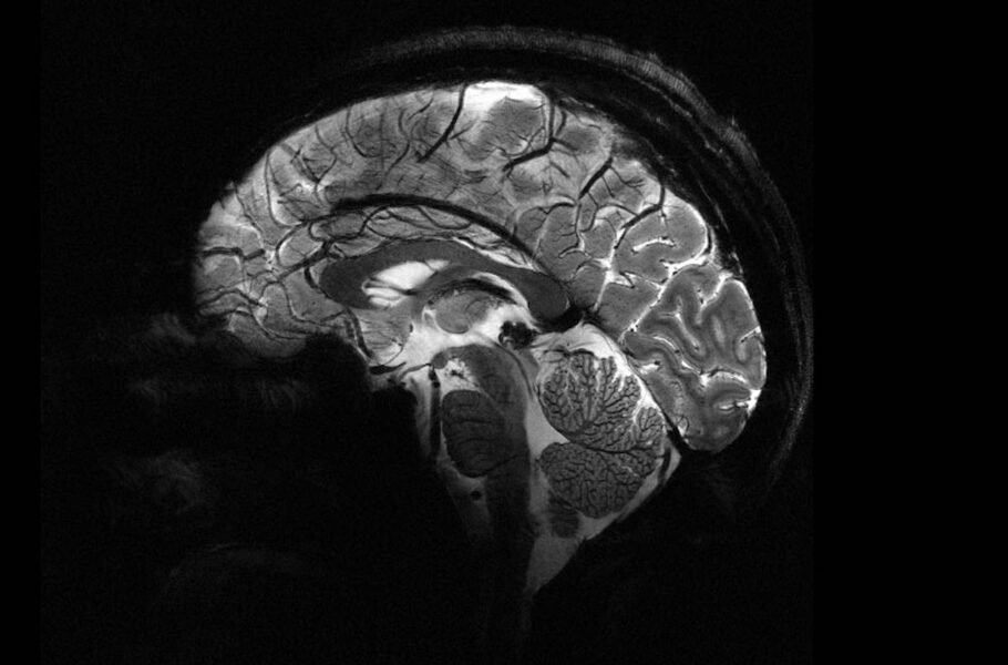 قدرتمندترین MRI جهان