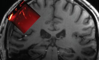 پنجره‌ای به درون جمجمه