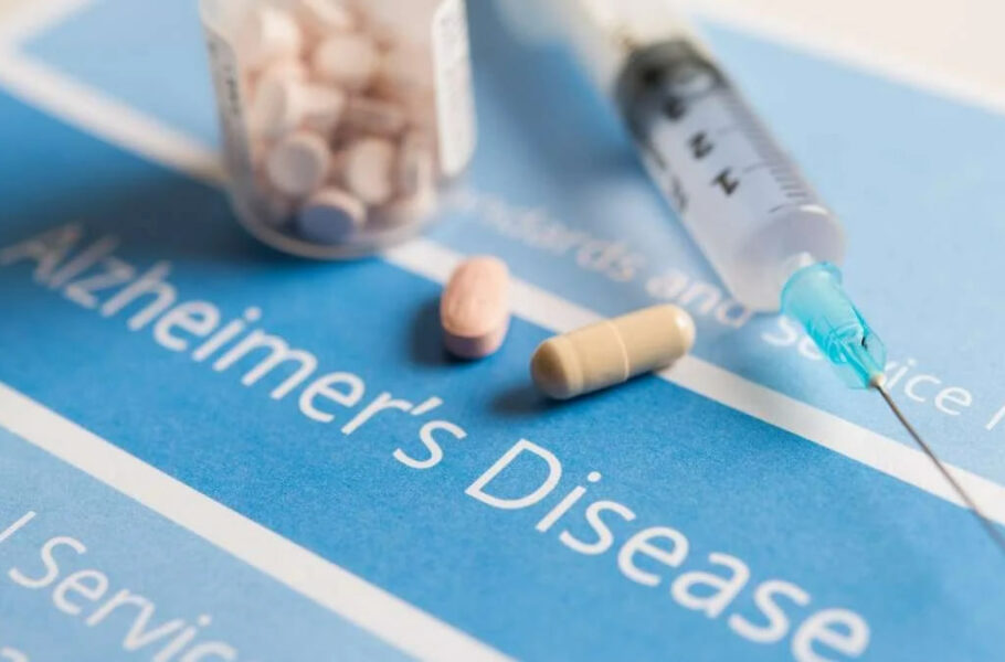 آلزایمر