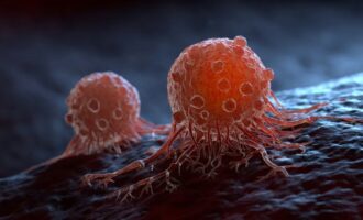 سلول سرطانی