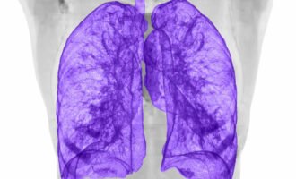 تصویربرداری ریه